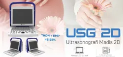 USG 2D ALKESSI - USG 2D ~blog/2025/7/24/gbr usg 2d